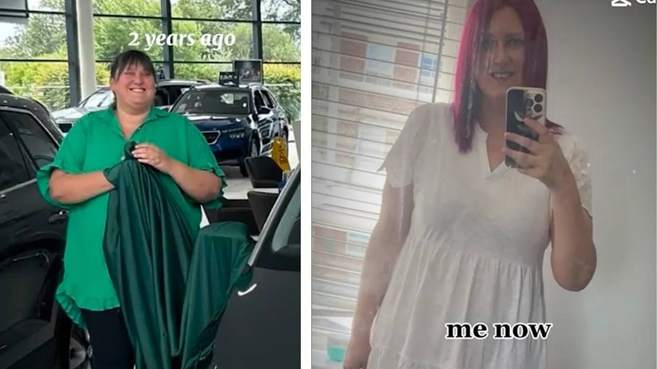 英女成功减肥95公斤变窈窕，嫌皮肤变松飞土耳其整形！竟差点丧命（组图） - 1