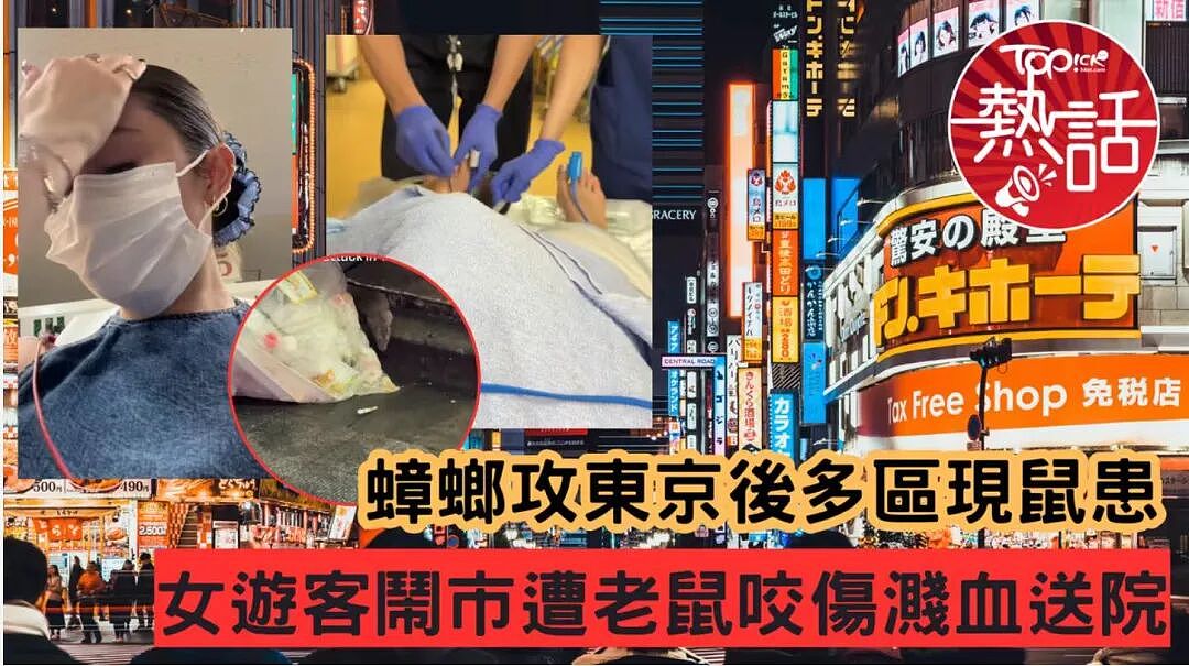 外籍游客东京漫步被老鼠咬伤血流不止、伤口发黑,网友:东京的卫生神话破灭(组图) - 6