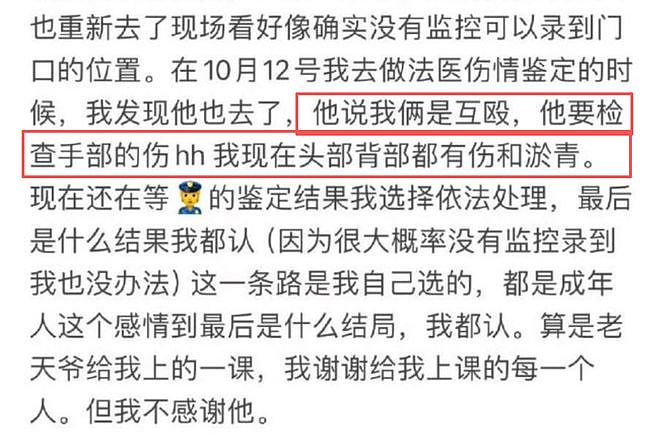 大瓜!中国爆火童星被指“脚踏三只船+殴打女友”,女方晒报警回执(组图) - 13