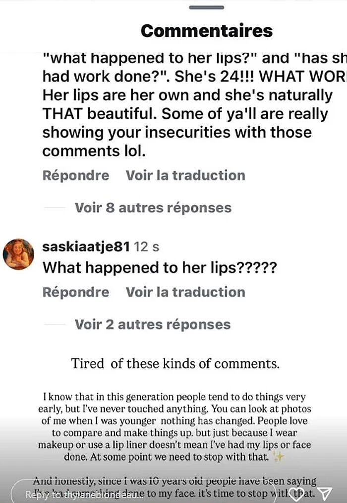 世界最美女孩整成了梅拉尼娅?她被瓜友看着长大,一路遭遇颜值审判…(组图) - 13