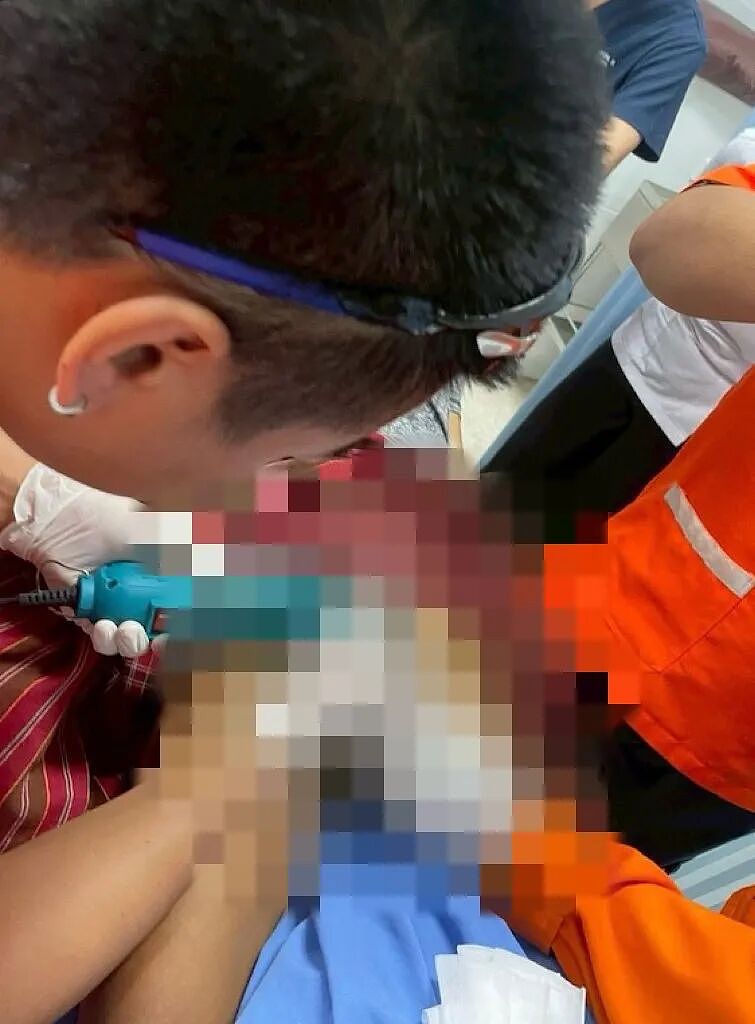 男子“丁丁”太大怕被偷走，套上双层钢圈，然后出不来了，医生：要不先治脑子吧（组图） - 2