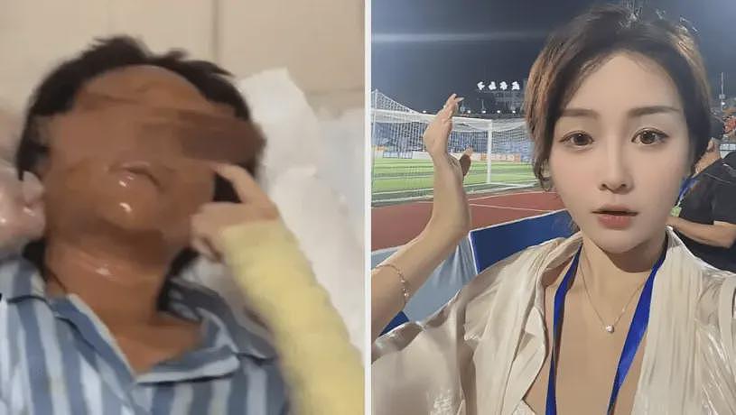收到伪装成快递的炸弹包裹，中国美女主播被炸（组图） - 1