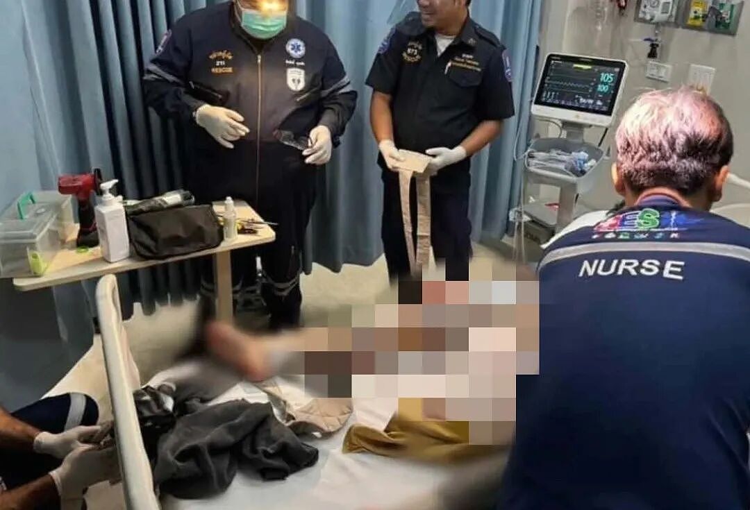 男子“丁丁”太大怕被偷走，套上双层钢圈，然后出不来了，医生：要不先治脑子吧（组图） - 5