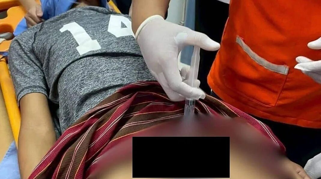 男子“丁丁”太大怕被偷走，套上双层钢圈，然后出不来了，医生：要不先治脑子吧（组图） - 1