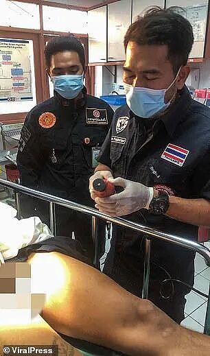 男子担心自己丁丁太大被偷,出奇招用钢圈套上,结果取不出来了...(组图) - 9