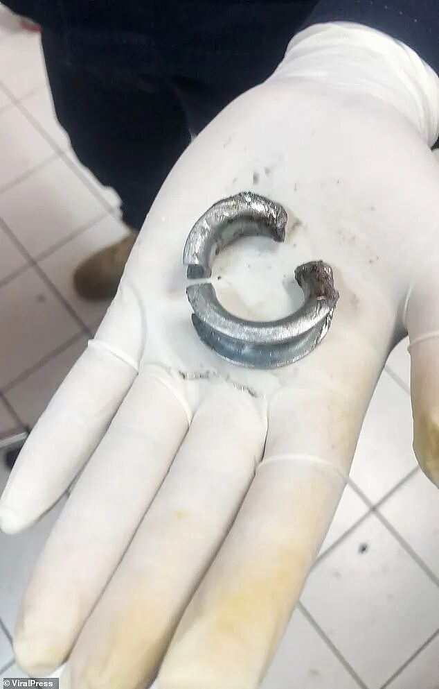男子担心自己丁丁太大被偷,出奇招用钢圈套上,结果取不出来了...(组图) - 10