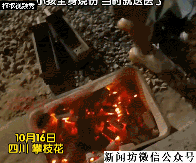 3岁男童不慎掉进炭火堆，全身85%烧伤，母亲徒手救出！网友：光看就疼得不行！父母发声（视频/组图） - 1