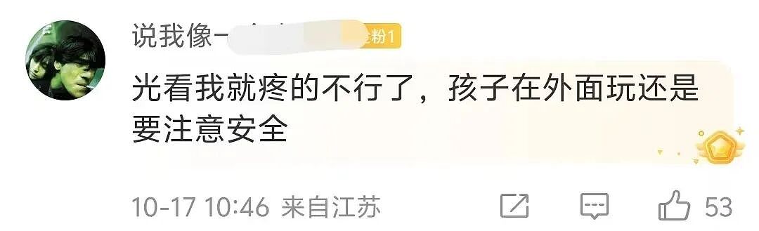 3岁男童不慎掉进炭火堆，全身85%烧伤，母亲徒手救出！网友：光看就疼得不行！父母发声（视频/组图） - 8