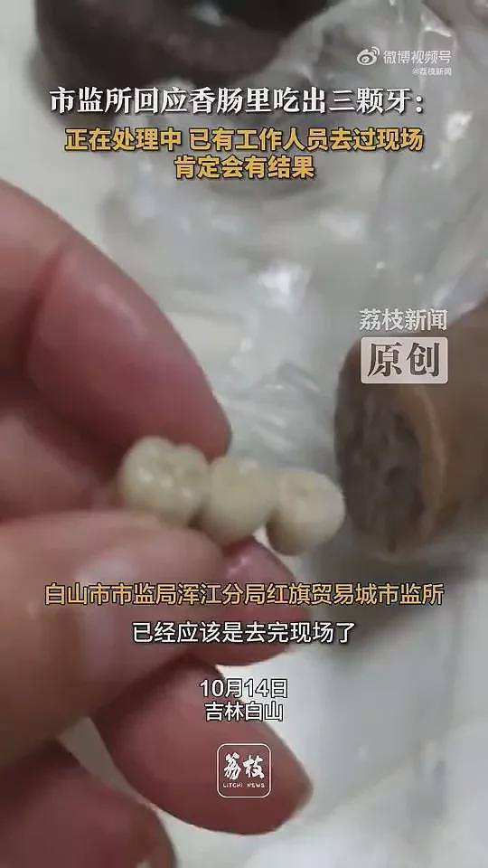 吉林香肠、东莞烧卖…接连有人吃到“人类牙齿”（组图） - 4