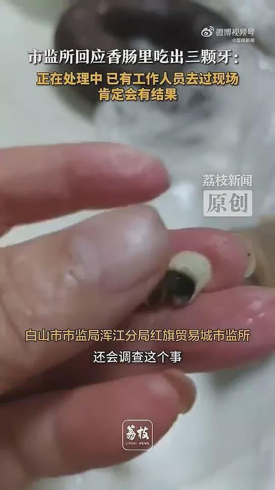 吉林香肠、东莞烧卖…接连有人吃到“人类牙齿”（组图） - 6