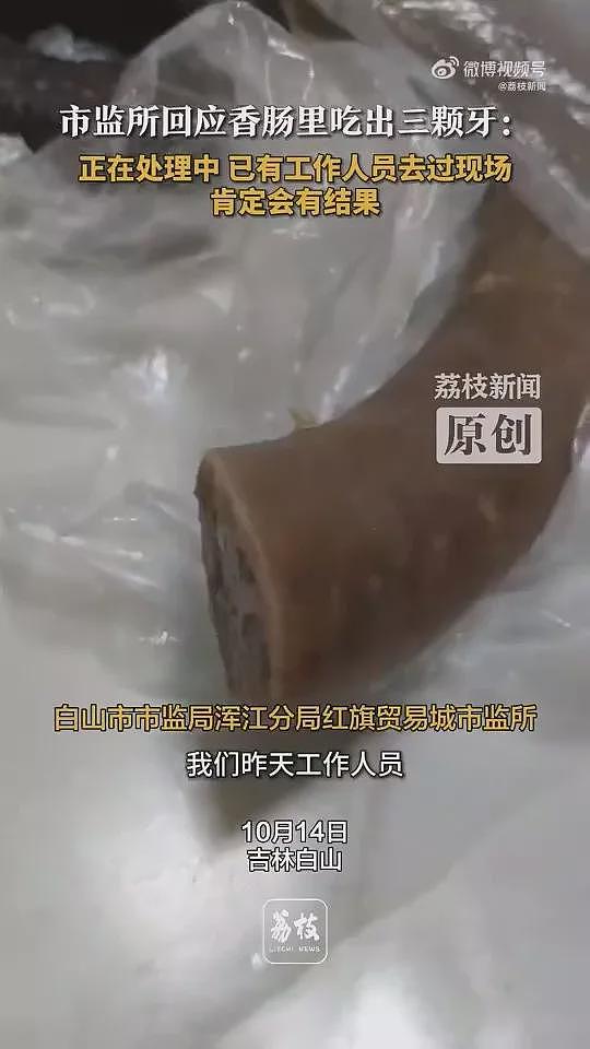 吉林香肠、东莞烧卖…接连有人吃到“人类牙齿”（组图） - 3