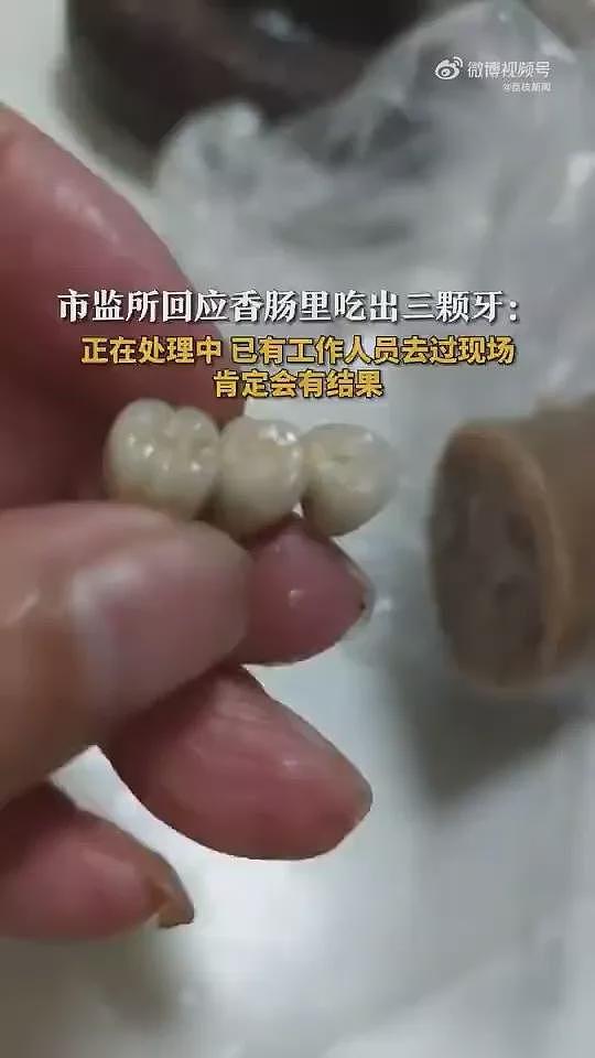 吉林香肠、东莞烧卖…接连有人吃到“人类牙齿”（组图） - 2