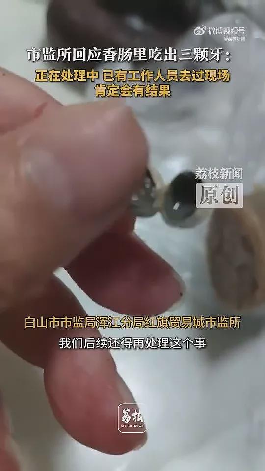 吉林香肠、东莞烧卖…接连有人吃到“人类牙齿”（组图） - 5