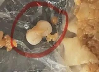 吉林香肠、东莞烧卖…接连有人吃到“人类牙齿”（组图） - 7