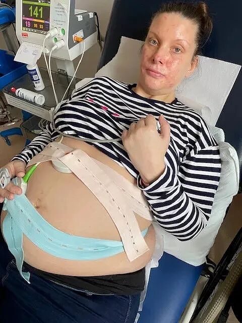 流产后,医生竟把一半胎儿留在她体内!她上厕所排出头骨碎片,惊呆了...(组图) - 4