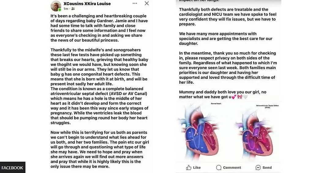 妹子刚生完娃两天，说娃死了？家人这才发现她怀孕全程都是装的，还“分娩”了（组图） - 5