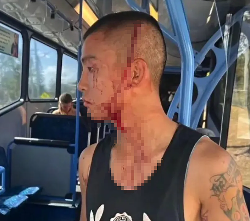 00后中国拳王在澳遭种族攻击，被群殴至昏迷！反遭同胞网暴：“别回国了”（组图） - 1