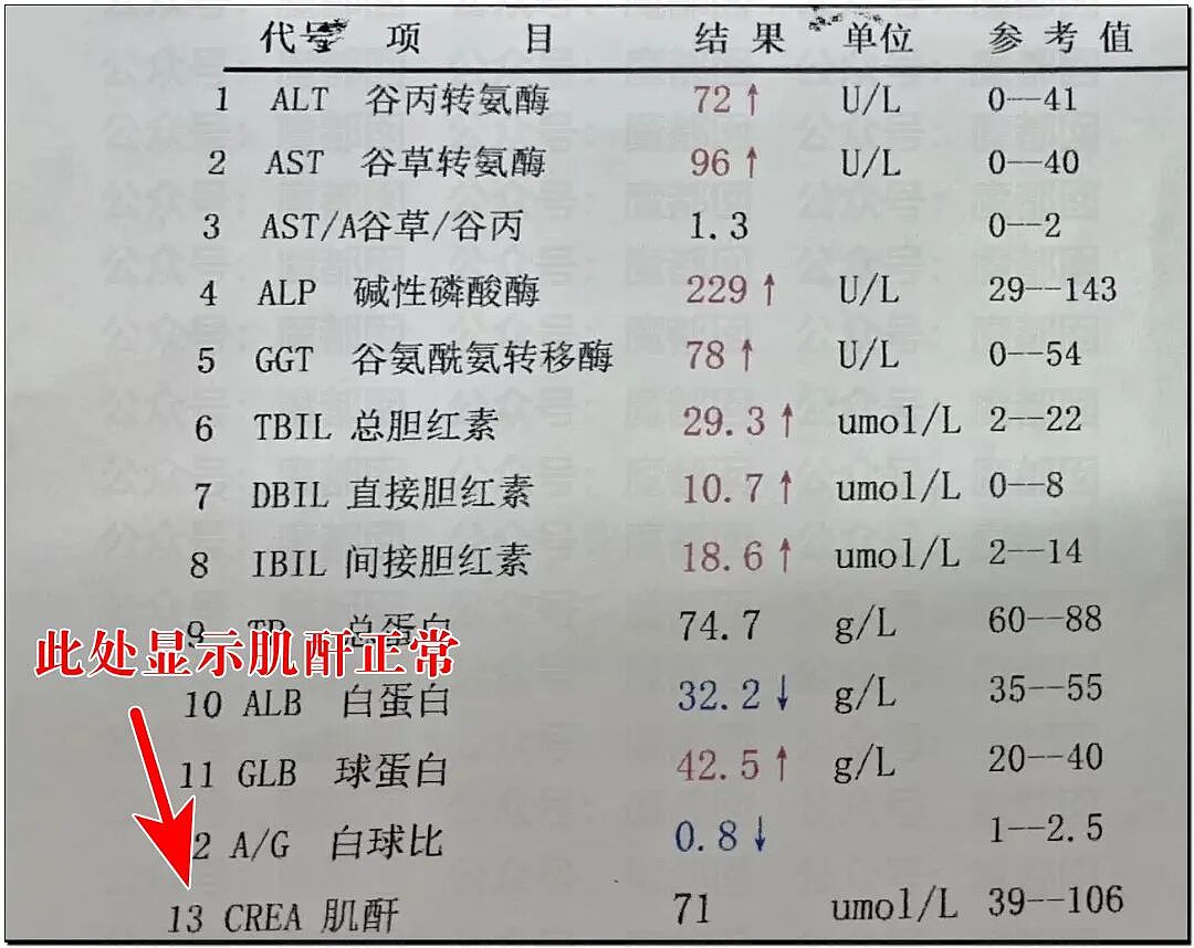 男生无节制每月频繁擦拭管道20余次突发尿血肾衰送ICU（视频/组图） - 2