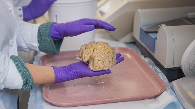 【涨知识】超级老人：80岁拥有50岁的大脑，科学家是如何解释的（组图） - 3