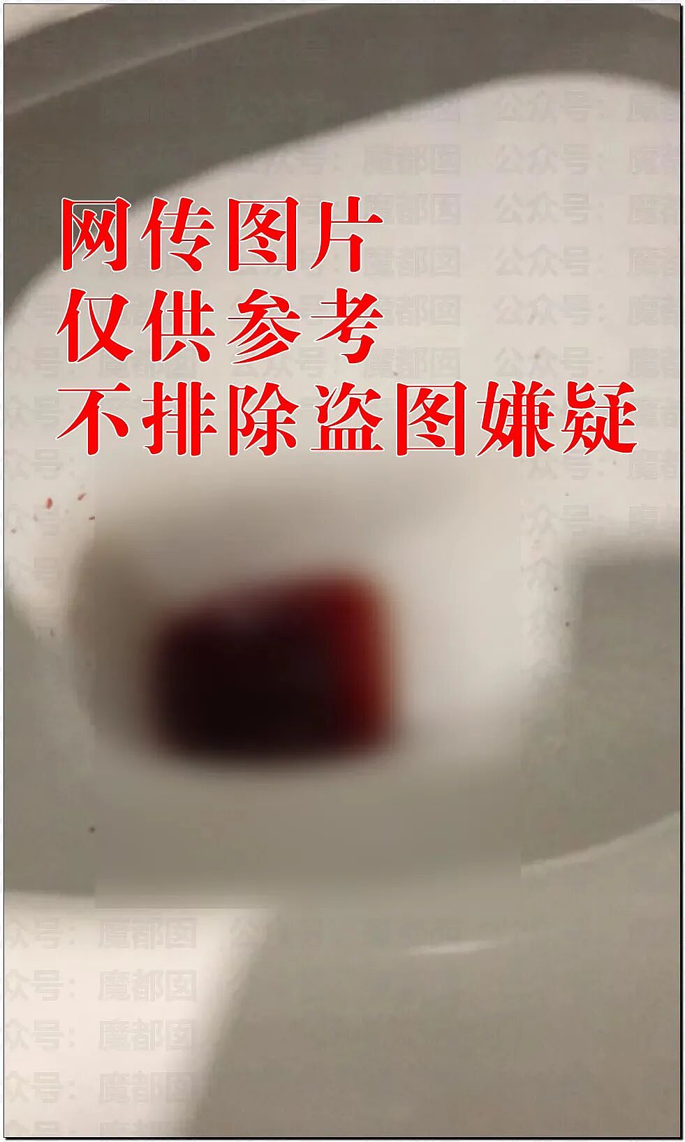 男生无节制每月频繁擦拭管道20余次突发尿血肾衰送ICU（视频/组图） - 1