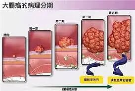 真逆天!澳洲又发明惊世“黑科技”,一颗药丸就能查出癌症!?未来或拯救百万人...(组图) - 8