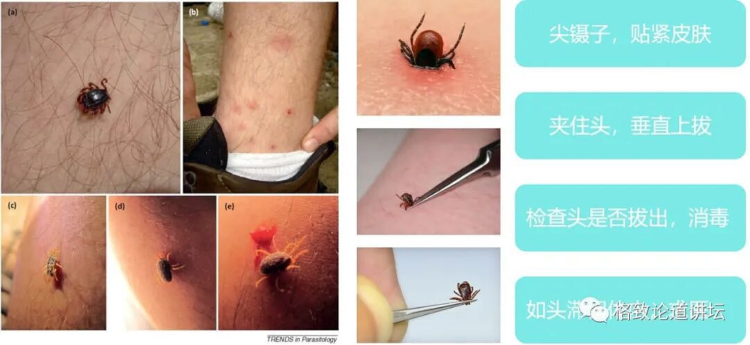 这种潜伏在我们身边的“吸血鬼”一生只吃三顿饭，但一顿就可能要人命（组图） - 22