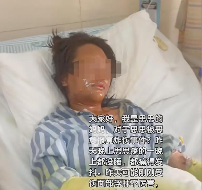 女主播被伪装快递盒炸伤，本人回应与“榜一大哥”爱恨情仇言论（组图） - 1