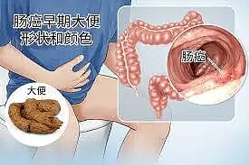 真逆天!澳洲又发明惊世“黑科技”,一颗药丸就能查出癌症!?未来或拯救百万人...(组图) - 13