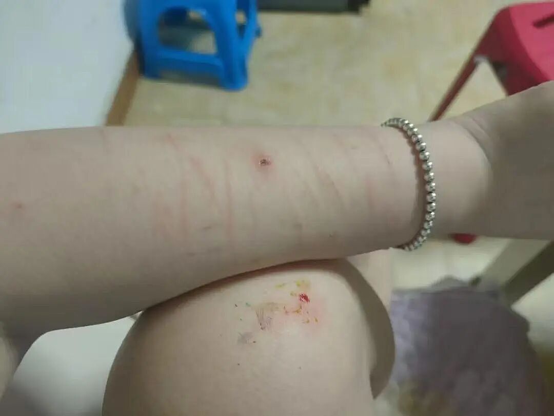 河南女孩在教室被篮球砸中头部后确诊癔症，女孩母亲：为治病借网贷，丈夫去非洲打工（组图） - 3