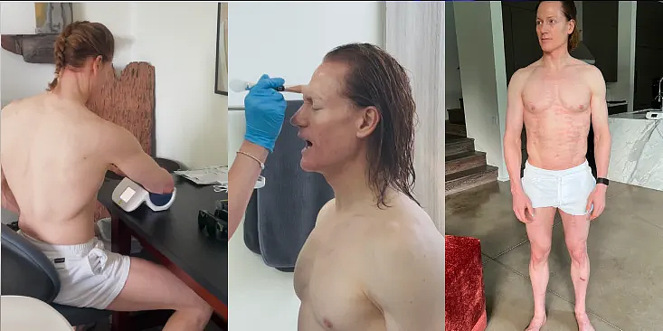 离谱!亿万富翁“换血哥”自曝每天蒸93度桑拿+冰敷丁丁,已成功全身排毒脱胎换骨?(组图) - 8