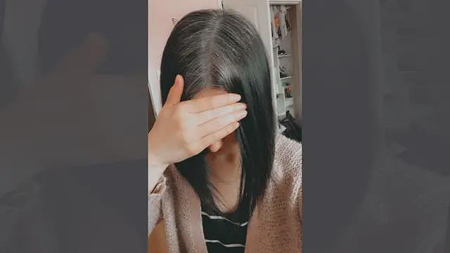 【涨知识】我为什么在14岁就长白发了,还有办法逆转吗(组图) - 5