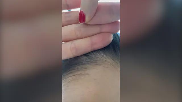 【涨知识】我为什么在14岁就长白发了,还有办法逆转吗(组图) - 4