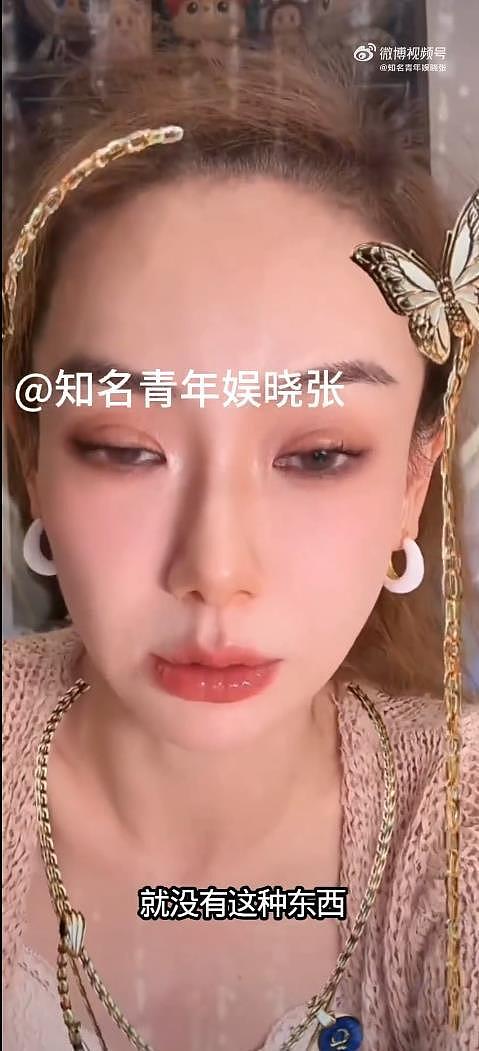 戚薇回应李承铉看中医：不觉得有什么无法启齿（组图） - 4