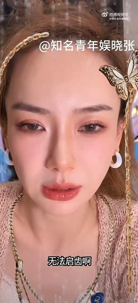 戚薇回应李承铉看中医：不觉得有什么无法启齿（组图） - 3