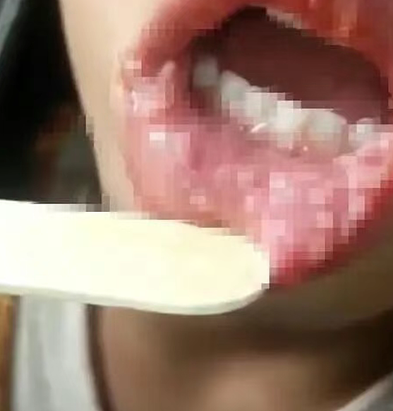 美女骑手染梅毒又传给3男,网传胸口多处斑点照太吓人…(组图) - 9
