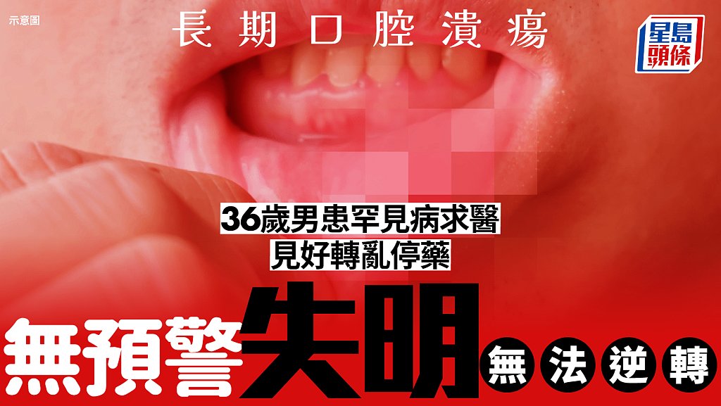 痱滋当热气！36岁男长期口腔溃疡，见好转乱停治疗导致无预警失明（组图） - 1