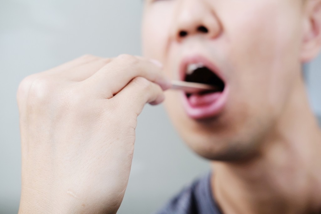 痱滋当热气！36岁男长期口腔溃疡，见好转乱停治疗导致无预警失明（组图） - 3
