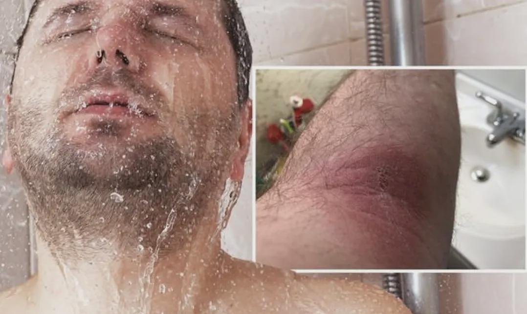 男子酒店洗澡被活活烫死！58℃热水如“烫猪皮”，瞬间皮开肉绽！家属崩溃...（组图） - 6