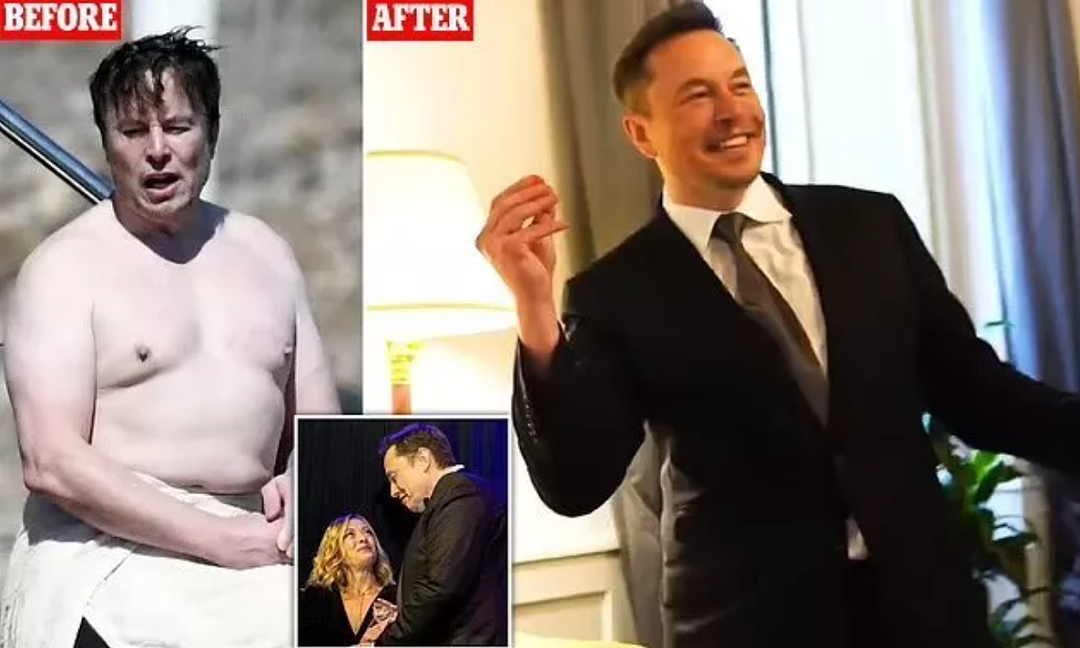 从贝佐斯到马斯克，硅谷科技男都想变帅？各种打针开刀，也颜值焦虑上了...（组图） - 5