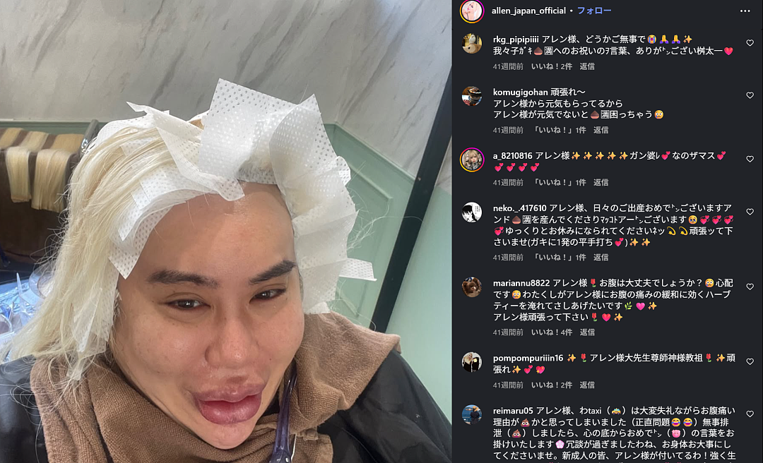 日本男子励志成为“世界第一美男”！10年间花费上亿整容，却把自己整成了女人？（组图） - 37