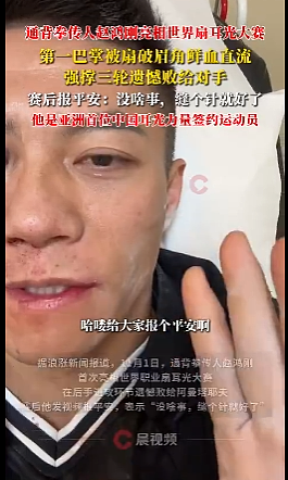 华人通背拳传人出战“扇耳光大赛”!连挨三掌惨被KO,场面太真实了(视频/组图) - 4
