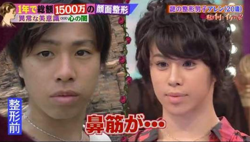 日本男子励志成为“世界第一美男”！10年间花费上亿整容，却把自己整成了女人？（组图） - 7
