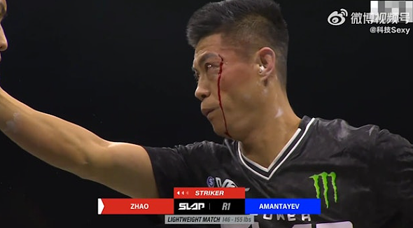 华人通背拳传人出战“扇耳光大赛”!连挨三掌惨被KO,场面太真实了(视频/组图) - 2