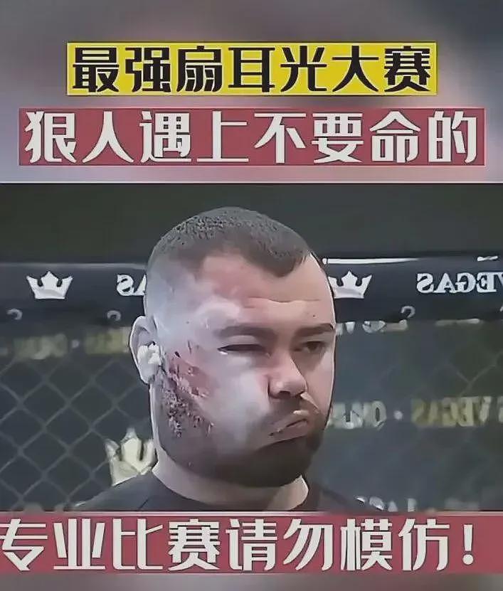 扇耳光大赛赵鸿刚多打2次仍失败,网友期待其师傅出战(视频/组图) - 7