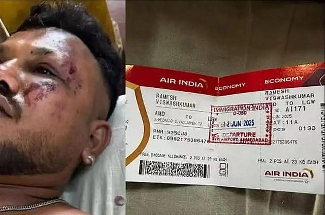 印度航空空难唯一幸存者:饱受PTSD折磨,无法与妻儿说话(组图) - 3