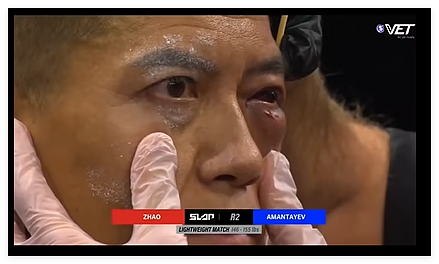 通背拳传人被几个耳光KO了,算不算传武的至暗时刻(组图) - 5