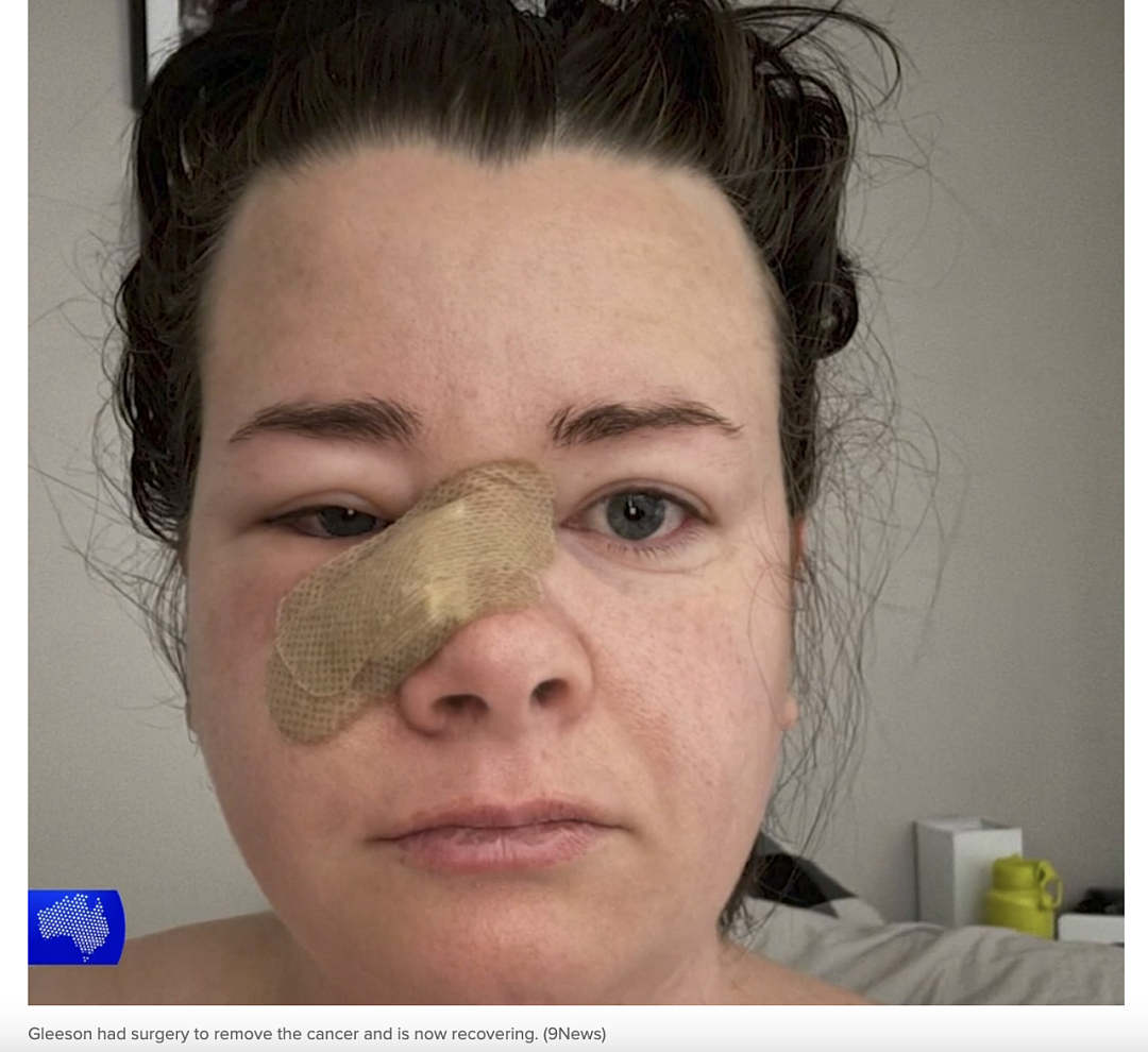 警惕！澳洲年轻妈妈用防晒霜，却得了皮肤癌！21款知名品牌全部翻车，妈妈们请避雷...（组图） - 6