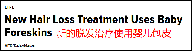 男性被割下的13亿块包皮,究竟去了哪里?(组图) - 7