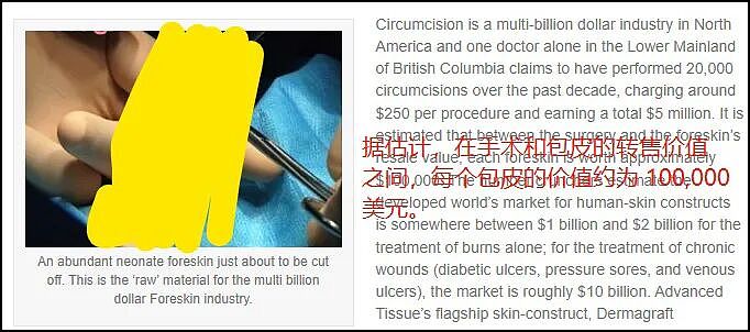 男性被割下的13亿块包皮,究竟去了哪里?(组图) - 3