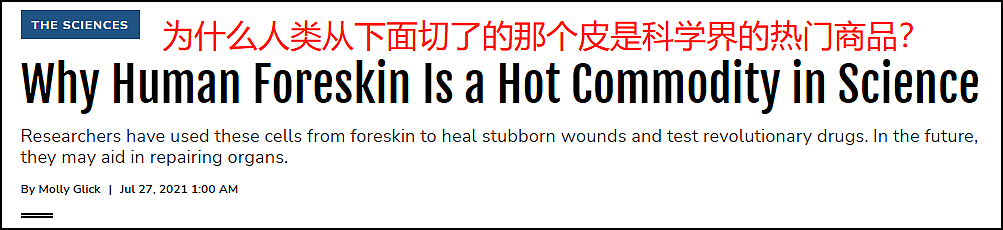 男性被割下的13亿块包皮,究竟去了哪里?(组图) - 6